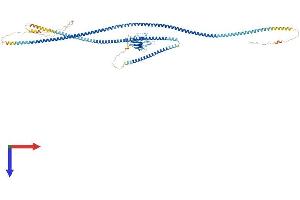 SLMAP Protein (AA 1-828) (His tag)