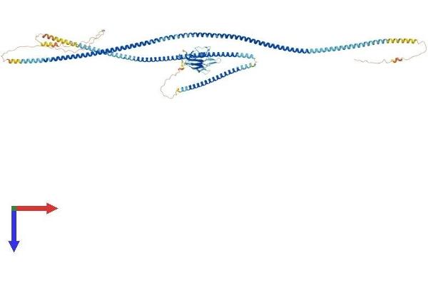 SLMAP Protein (AA 1-828) (His tag)