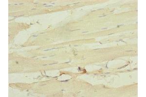 Immunohistochemistry of paraffin-embedded human skeletal muscle tissue using ABIN7160531 at dilution of 1:100 (MYL1 Antikörper  (AA 1-150))
