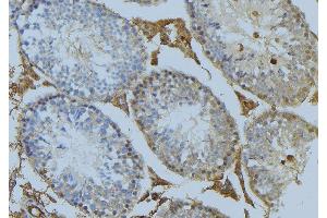 ABIN6274993 at 1/100 staining Mouse testis tissue by IHC-P. (CEP78 Antikörper  (Internal Region))