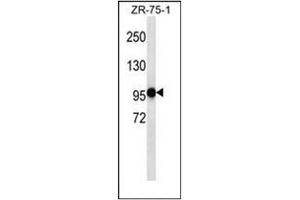 Western blot analysis of PHF14 Antibody (N-term) in ZR-75-1 cell line lysates (35ug/lane). (PHF14 Antikörper  (N-Term))