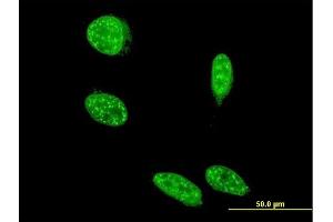 Immunofluorescence of monoclonal antibody to SAP18 on HeLa cell. (SAP18 Antikörper  (AA 1-153))