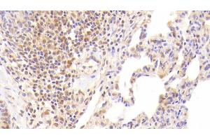 Detection of F2 in Human Lung Tissue using Monoclonal Antibody to Coagulation Factor II (F2) (Prothrombin Antikörper)