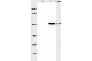 Lane 1: rat liver lysates Lane 2: rat brain lysates probed with Anti CK12/Cytokeratin 12 Polyclonal Antibody, Unconjugated (ABIN872955) at 1:200 in 4 °C. (KRT12 Antikörper  (AA 151-250))