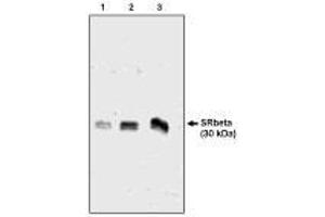 Image no. 1 for anti-Signal Recognition Particle Receptor, B Subunit (SRPRB) antibody (ABIN290618) (SRPRB Antikörper)