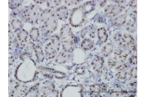 Image no. 3 for anti-Pre-B-Cell Leukemia Transcription Factor 3 (PBX3) (AA 342-435) antibody (ABIN598856) (PBX3 Antikörper  (AA 342-435))