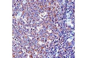 CD43 antibody immunohistochemistry analysis in formalin fixed and paraffin embedded human tonsil tissue.