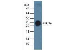 Detection of SP-C in Human Serum using Polyclonal Antibody to Surfactant Protein C (SP-C) (Surfactant Protein C Antikörper  (AA 24-197))