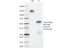 SDS-PAGE Analysis Purified p63 Mouse Monoclonal Antibody (TP63/11). (p63 Antikörper)
