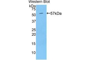 Western blot analysis of the recombinant protein. (TGM1 Antikörper  (AA 496-760))
