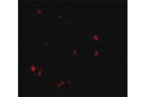 Immunofluorescence staining of human brain tissue with 20 ug/mL LASS5 polyclonal antibody .