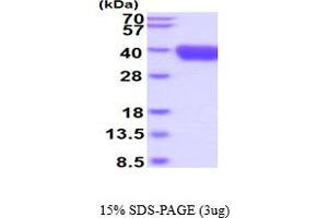 SDS-PAGE (SDS) image for Tumor-Associated Calcium Signal Transducer 2 (TACSTD2) (AA 31-274) protein (His tag) (ABIN5854731)