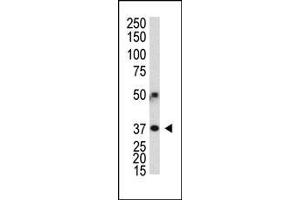 Polyclonal antibody (ABIN388486 and ABIN2849574) was used in Western blot to detect human G3L in transfected 293 cells. (ATG3 Antikörper  (N-Term))