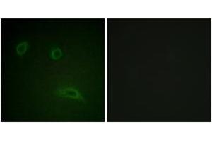 Immunofluorescence analysis of HeLa cells, using HER2 (Ab-1139) Antibody. (ErbB2/Her2 Antikörper  (AA 1111-1160))