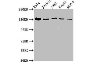 Western Blot Positive WB detected in: Hela whole cell lysate, Jurkat whole cell lysate, 293T whole cell lysate, HepG2 whole cell lysate, MCF-7 whole cell lysate All lanes: CAND1 antibody at 4. (CAND1 Antikörper  (AA 1150-1230))