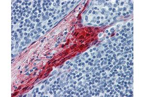 Anti-SPRR3 antibody IHC of human tonsil. (SPRR3 Antikörper  (AA 1-162))