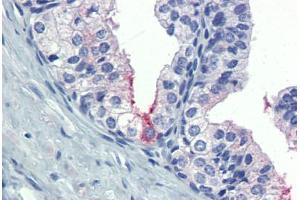 Prostate: Formalin-Fixed, Paraffin-Embedded (FFPE) (AMH Antikörper  (AA 468-517))