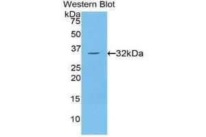 Western Blotting (WB) image for anti-Protein Kinase C, eta (PRKCH) (AA 355-614) antibody (ABIN1860237) (PKC eta Antikörper  (AA 355-614))