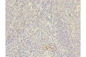 Immunohistochemistry (IHC) image for anti-Nudix (Nucleoside Diphosphate Linked Moiety X)-Type Motif 2 (NUDT2) (AA 1-147) antibody (ABIN7145623)