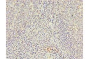 Immunohistochemistry of paraffin-embedded human tonsil tissue using ABIN7145623 at dilution of 1:100 (NUDT2 Antikörper  (AA 1-147))