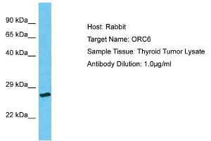 Host: Rabbit Target Name: ORC6 Sample Type: Thyroid Tumor lysates Antibody Dilution: 1.