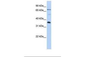 Image no. 1 for anti-LIM and SH3 Protein 1 (LASP1) (AA 182-231) antibody (ABIN6738999) (LASP1 Antikörper  (AA 182-231))