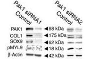 Decreases in the levels of activated HSC markers, SOX9, COL1 and phosphoMyl9 (PMYL9) following PAK-1 abrogation by siRNA1 in activated rat HSCs relative to their respective scrambled control levels. (Collagen Type I Antikörper)