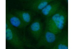 Cells exposed to anisomycin for 30 minutes (MAPK14 Antikörper  (pThr180))
