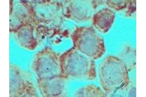 Image no. 2 for anti-Distal-Less Homeobox 3 (DLX3) (AA 220-270) antibody (ABIN960137) (DLX3 Antikörper  (AA 220-270))