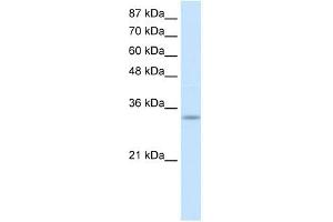Western Blotting (WB) image for anti-Protein Kinase, Interferon-Inducible Double Stranded RNA Dependent Activator (PRKRA) (Middle Region) antibody (ABIN634469)