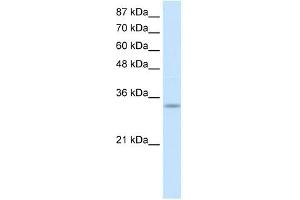 PRKRA antibody used at 1 ug/ml to detect target protein.