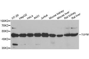 Western blot analysis of extracts of various cell lines, using TUFM antibody. (TUFM Antikörper  (AA 186-455))