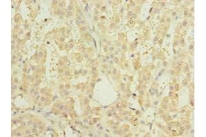 Immunohistochemistry of paraffin-embedded human adrenal gland tissue using ABIN7151150 at dilution of 1:100 (RNF138 Antikörper  (AA 2-245))