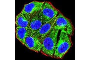Immunofluorescence (IF) image for anti-ADAM Metallopeptidase Domain 8 (ADAM8) (AA 17-156) antibody (ABIN7193315)