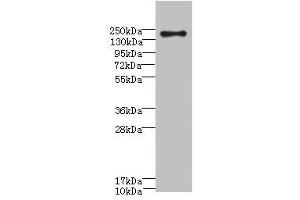 Western blot All lanes: CR1 antibody at 3. (CD35 Antikörper  (AA 420-550))
