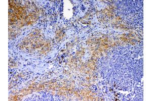 Immunohistochemistry (IHC) image for anti-CD40 Ligand (CD40LG) (AA 107-260) antibody (ABIN5692813)
