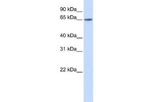 WB Suggested Anti-YTHDF3 Antibody Titration: 0.