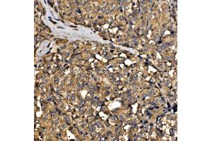 IHC analysis of SRP72 using anti-SRP72 antibody (ABIN7601648). (SRP72 Antikörper  (AA 40-460))