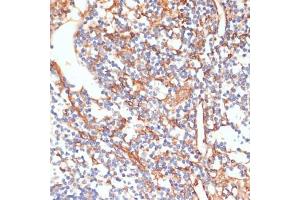 Immunohistochemistry of paraffin-embedded human appendix using Phospho-Vimentin-S39 antibody (ABIN7271327) at dilution of 1:100 (40x lens).