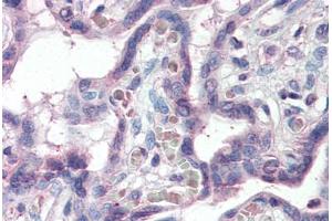 Human Placenta (formalin-fixed, paraffin-embedded) stained with SLC12A4 antibody ABIN337105 at 5 ug/ml followed by biotinylated anti-goat IgG secondary antibody ABIN481715, alkaline phosphatase-streptavidin and chromogen. (SLC12A4 Antikörper  (AA 997-1007))
