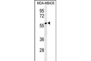 Western blot analysis of NARFL Antibody (Center) (ABIN653781 and ABIN2843068) in MDA-M cell line lysates (35 μg/lane).