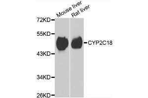 Western blot analysis of extracts of various cell lines, using CYP2C18 antibody. (CYP2C18 Antikörper  (AA 231-490))