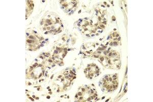 Immunohistochemistry (Paraffin-embedded Sections) (IHC (p)) image for anti-PRP3 Pre-mRNA Processing Factor 3 Homolog (PRPF3) (AA 1-280) antibody (ABIN6146260)