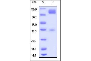 SDS-PAGE (SDS) image for Poliovirus Receptor (PVR) (AA 29-348) (Active) protein (Fc Tag) (ABIN5674647)