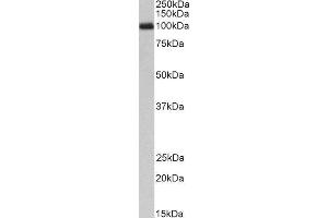 ABIN4902636 (1µg/ml) staining of Peripheral Blood Lymphocytes lysate (35µg protein in RIPA buffer). (CSF3R Antikörper)