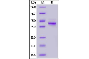 SDS-PAGE (SDS) image for Mucin 1 (MUC1) (AA 254-373) protein (Fc Tag) (ABIN7013641)