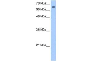 Western Blotting (WB) image for anti-Synovial Apoptosis Inhibitor 1, Synoviolin (SYVN1) antibody (ABIN2462686) (SYVN1 Antikörper)