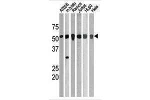 Image no. 1 for anti-Checkpoint Kinase 1 (CHEK1) (pSer280) antibody (ABIN358108) (CHEK1 Antikörper  (pSer280))