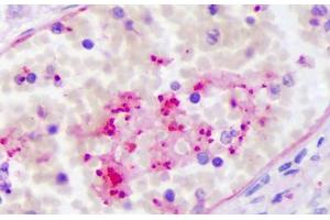Anti-PPBP antibody IHC staining of human intravascular platelets. (CXCL7 Antikörper)