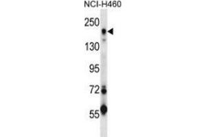 Western blot analysis in NCI-H460 cell line lysates (35ug/lane) using CD280 / MRC2 Antibody . (MRC2 Antikörper  (Middle Region))